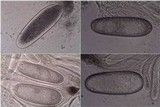 Pertusaria ophthalmiza image