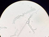 Penicillium vulpinum image