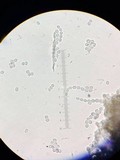 Penicillium vulpinum image