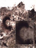 Melaspilea diplasiospora image