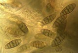Capronia nigerrima image