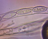 Plectania milleri image