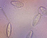 Plectania milleri image