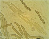 Lasiosphaeris hirsuta image