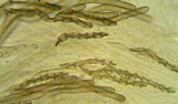 Lasiosphaeris hirsuta image