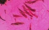 Lasiosphaeris hirsuta image