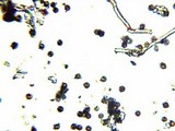 Fomitopsis officinalis image