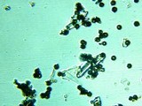 Fomitopsis officinalis image