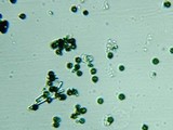 Fomitopsis officinalis image
