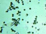 Fomitopsis officinalis image
