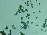 Fomitopsis officinalis image