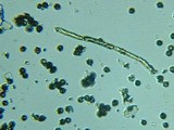 Fomitopsis officinalis image