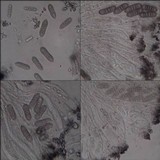 Phaeographis lyellii image