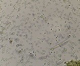Tolypocladium ophioglossoides image