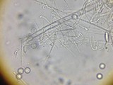 Pseudoplectania melaena image