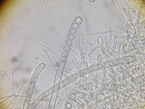 Pseudoplectania melaena image