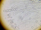Pseudoplectania melaena image