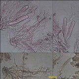 Enterographa crassa image