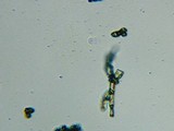 Fomitopsis officinalis image