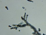 Fomitopsis officinalis image