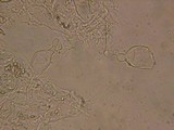 Aleurodiscus aurantius image
