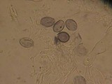 Aleurodiscus aurantius image