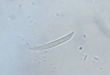 Fusicolla merismoides image