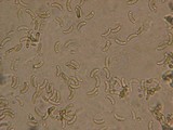Eutypa flavovirens image