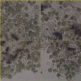 Diploschistes caesioplumbeus image