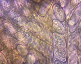 Plectania nannfeldtii image
