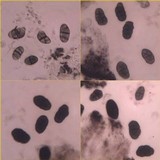 Rhizocarpon oportense image