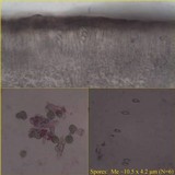 Protoparmelia badia image