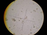 Tulostoma squamosum image