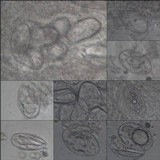 Ochrolechia parella image