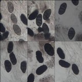 Rhizocarpon lecanorinum image