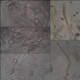 Acrocordia gemmata image