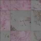 Enterographa hutchinsiae image