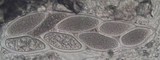 Pertusaria hymenea image