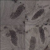 Phaeographis smithii image