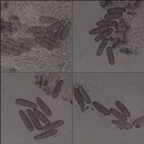 Phaeographis smithii image