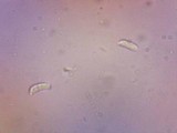 Craterocolla cerasi image