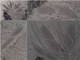 Pertusaria pustulata image