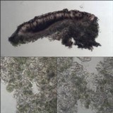Arthonia radiata image