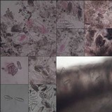 Arthonia radiata image