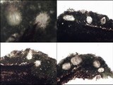 Enterographa hutchinsiae image