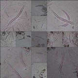 Enterographa hutchinsiae image