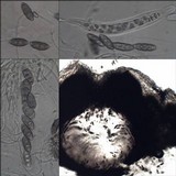 Pyrenula macrospora image