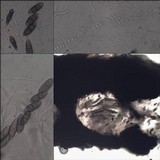 Pyrenula chlorospila image