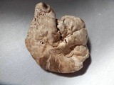 Agaricus subfloccosus image
