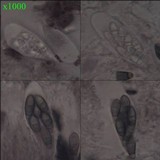 Arthonia elegans image